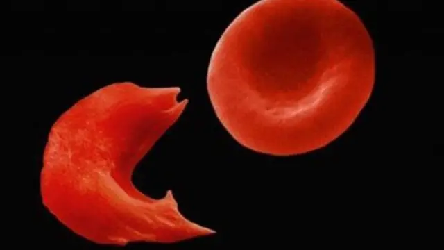 Red Blood Cells