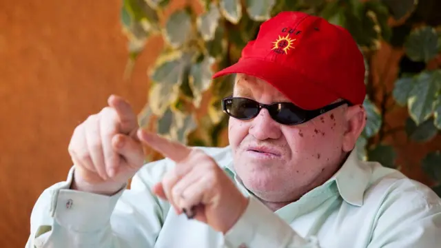 Tanzania first albino lawmaker, Salum Khalfan Barwany