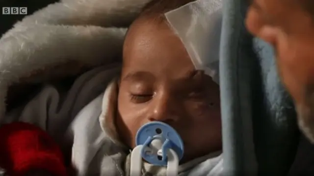 ብሓይልታት መንግስቲ ሶርያ ፀጋማይ ዓይኑ ዝተወቕዐ ወዲ ሰለስተ ወርሒ ህፃን ከሪም።