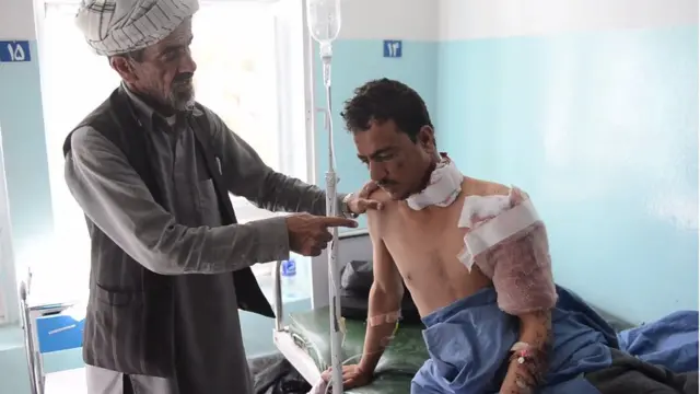 Un herido en un hospital afgano.