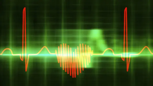 Юрак кардиограммаси