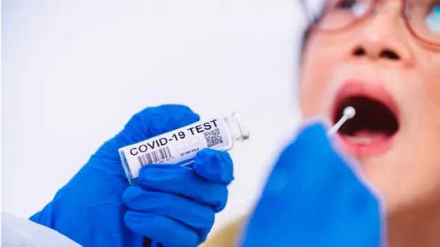 Una prueba de covid-19