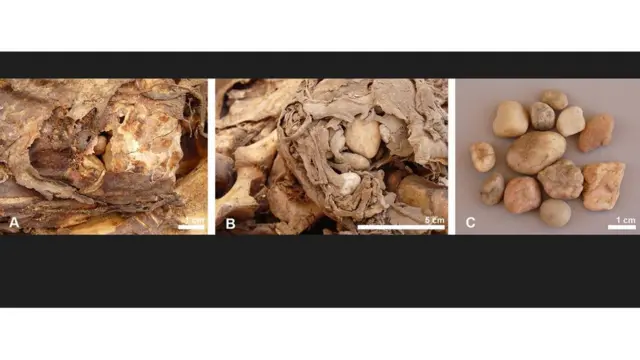 أحجار في بطن التماسيح