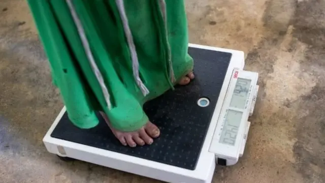 Zaidi ya watoto 7,000 walio na umri wa Chini ya miaka mitano wamefariki dunia katika mlipuko wa hivi karibuni