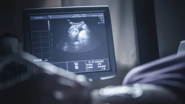 depresi, stres, melahirkan, hamil, depresi pascamelahirkan, perinatal depresi, baby blues, postmaternal depression, perempuan hamil, stres kehamilan