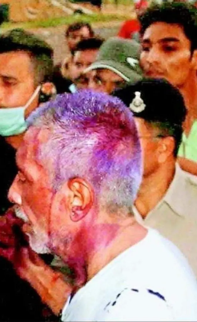 सोशल मीडिया पर प्रकाश झा की एक तस्वीर वायरल है जिसमें उन पर स्याही गिरी हुई है