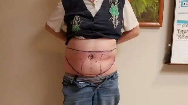 MD ANDERSON CANCER CENTER