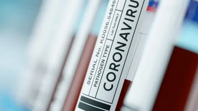 Covid-19
