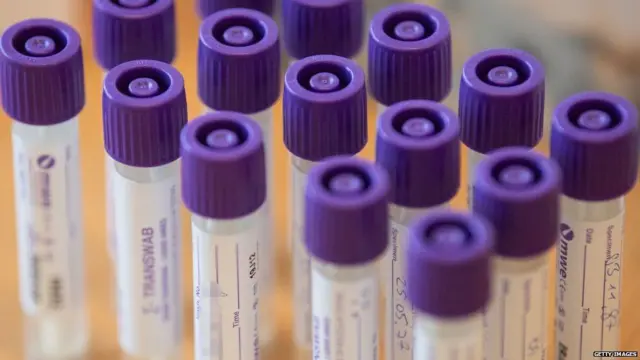 કોરોના ટેસ્ટિંગ