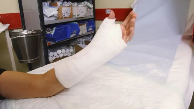 tulang, dokter, patah, kesehatan