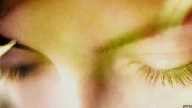 ब्रेन ट्यूमर