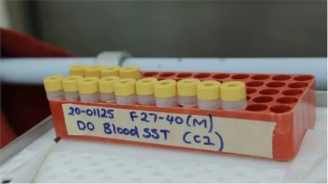 વૅક્સીનનું પરીક્ષણ