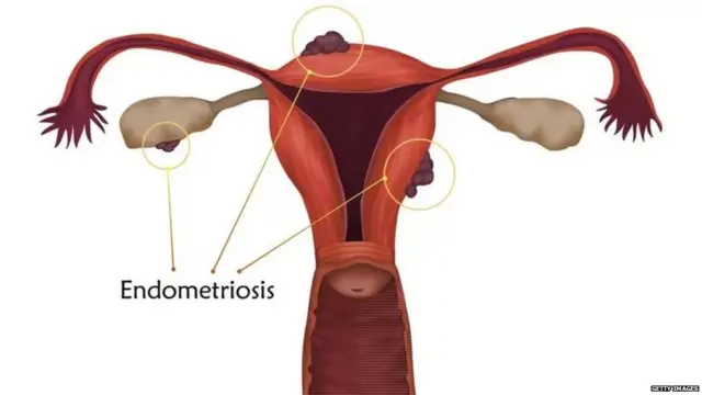 मासिक पाळी