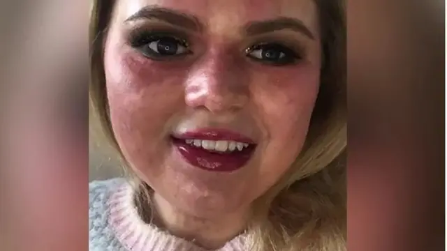 امبا سمېت
