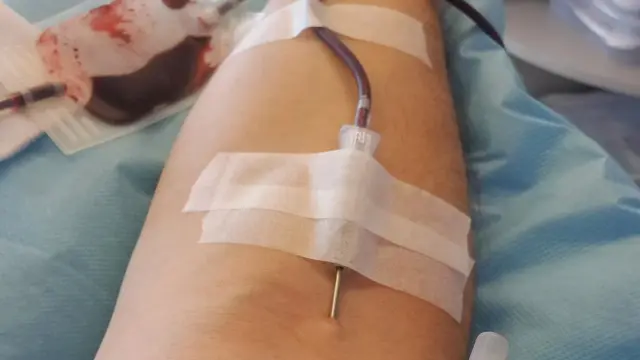 Transfusión de sangre