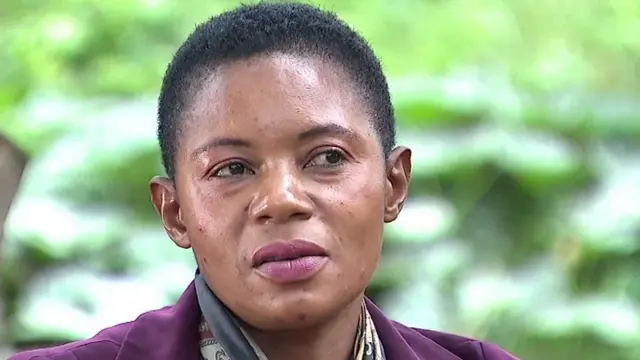 Jane Ndagire alitumia mafuta yanayochubua mwili kwenye uso wake kwa miaka kadhaa