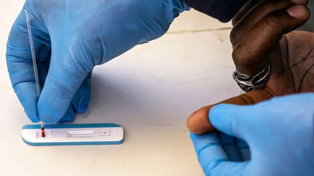 Dokita to n ṣe ayẹwo arun HIV