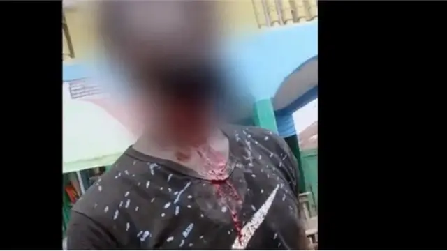 కుష్ మత్తులో యువత తమను తాము గాయపర్చుకుంటున్నారు