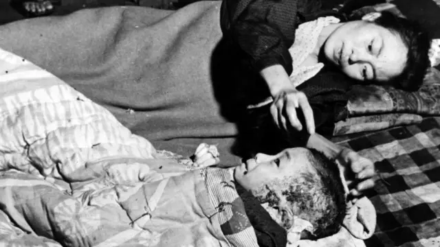 Хиросимадагы жарылуудан аман калып, жашап кеткендер бүтүндөй өмүрүн болуп өткөн окуядан алган психологиялык дартынан арыла албай жашап өтүшкөн.