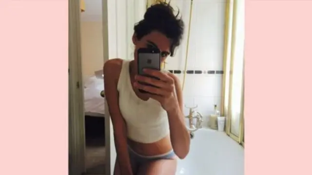 கவர்ச்சிப் படம்