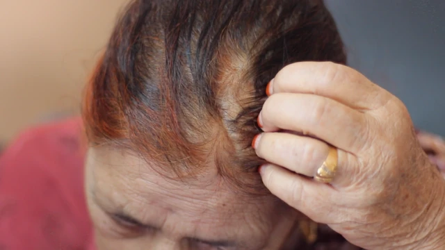 وزیرہ بیگم کے سر پر تلوار کے گھاؤ کا نشان