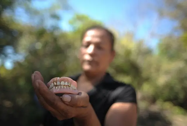 Míriam Núñez de Márquez muestra la dentadura postiza de su madre, víctima de la masacre de El Mozote.
