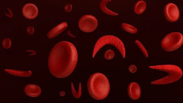 Bi ẹjẹ alarun runmọleegun se ri