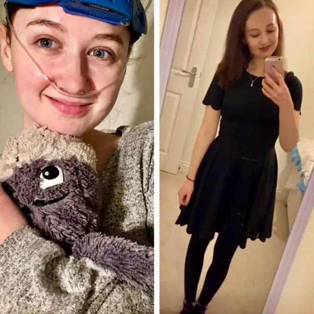 피파는 자신의 '보이지 않는' 질병에 대해 블로그에 글을 쓴다