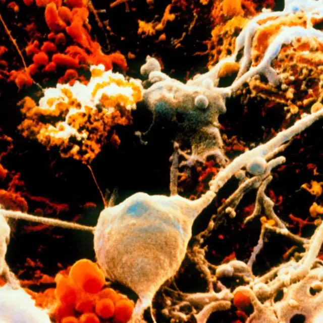 Neuronas y células gliales