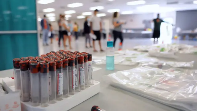 Tests en un laboratorio