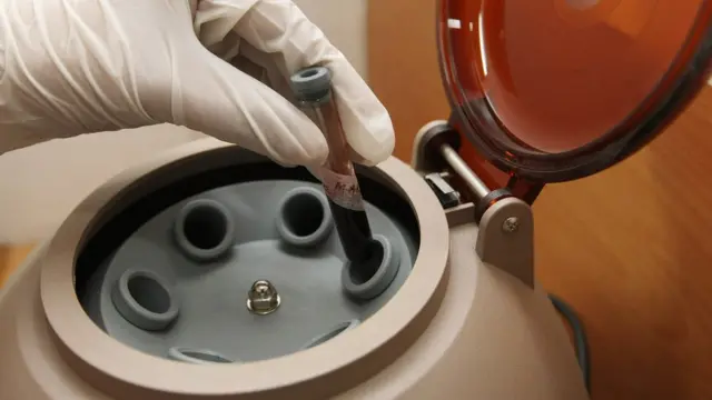菲律宾奎松市某诊所工作人员执行艾滋病血液检测