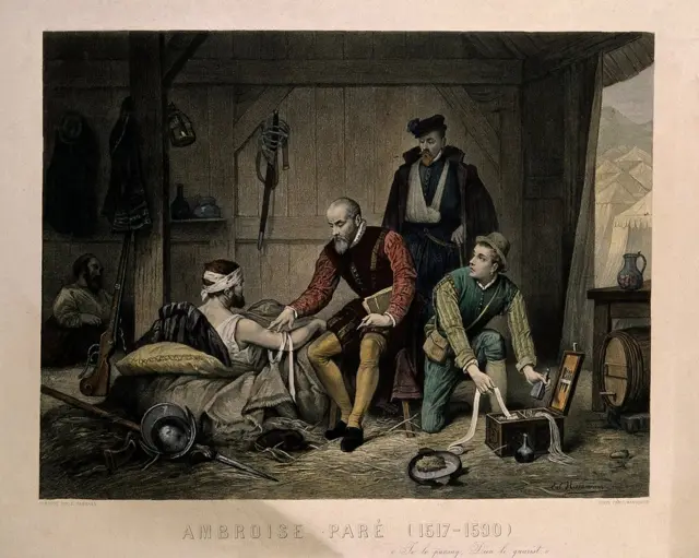 Grabado coloreado de C. Manigaud que representa a Ambroise Paré. (Foto: Iconographic Collections / Welcome Images vía Wikimedia Commons)