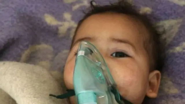 ژغورندویان وايي، ګڼ ماشومان د ادلب کیمیااوي برید کې وژل شوي او ټپیان شوي دي