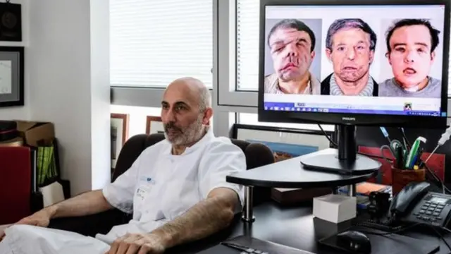 ফ্রান্স