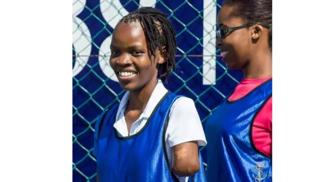 Dorcas Kero alizaliwa na mikono yake miwili miaka 31 iliyopita katika kaunti ya Taita-Taveta pwani ya Kenya lakini sasa hana mkono wake wa kushoto.