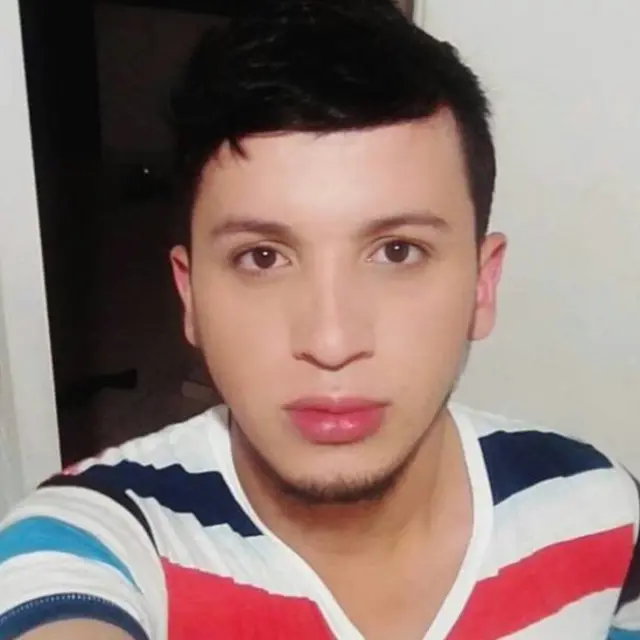 Jerson Trujillo antes de los procedimientos estéticos que la causaron daños graves en la cara.