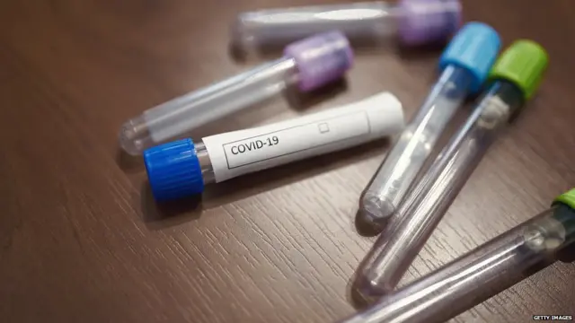 ਕੋਰੋਨਾਵਾਇਰਸ