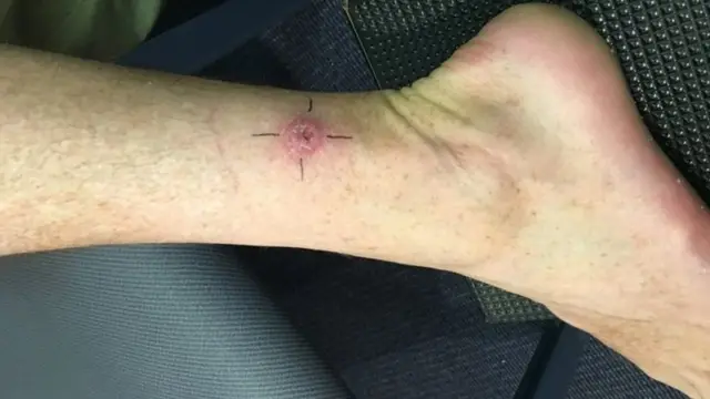 Qadimgi yunoncha pornografik grafikalar