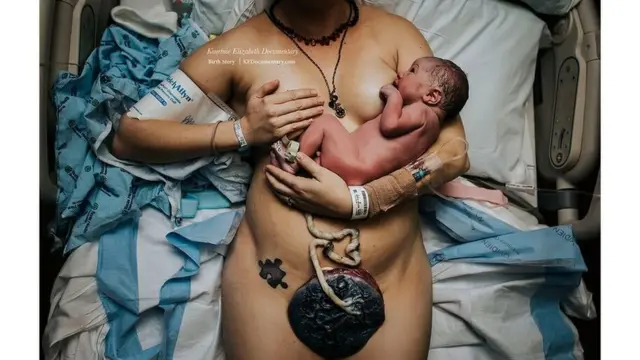 Foto ganadora de la categoría de Detalles del nacimiento: "Partes de mi", de Kourtnie Scholz - KEDocumentary