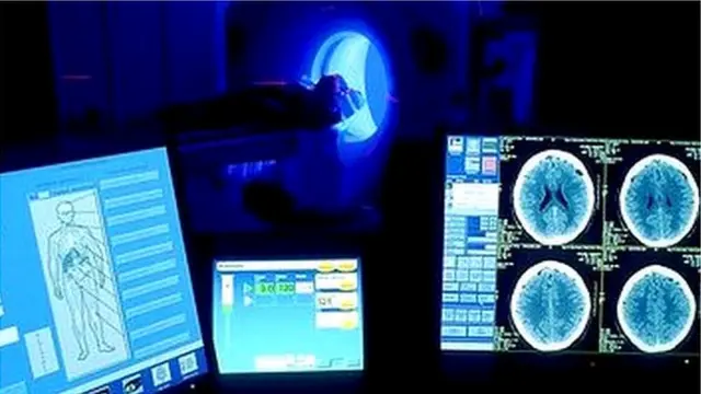 27 साल बाद कोमा से निकलने वाली महिला की कहानी