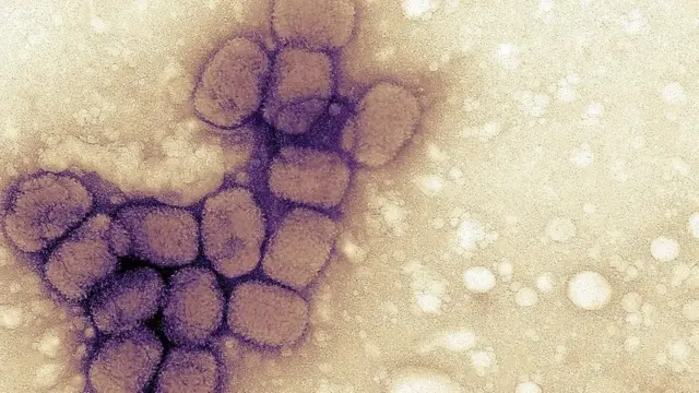 Методи лікування віспи