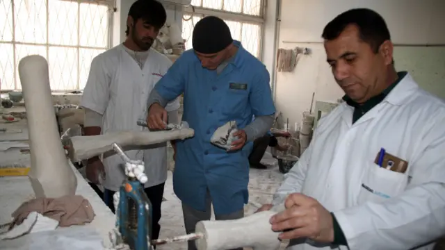 خدمات رایگان کارخانه اورتز و پروتز شهر دوشنبه