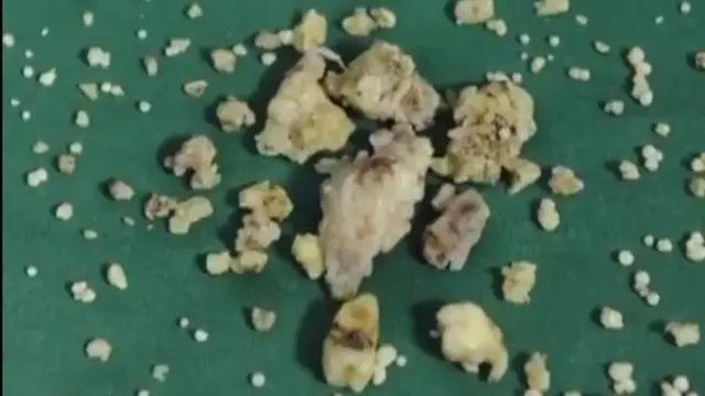 Eyin to le ni ẹẹdẹgbẹta