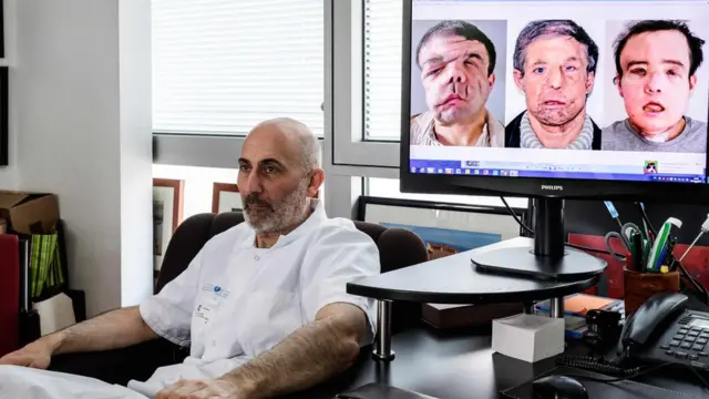 ศ.โรลองต์ ลาเทียรี ผู้ปลูกถ่ายใบหน้าให้นายอามง