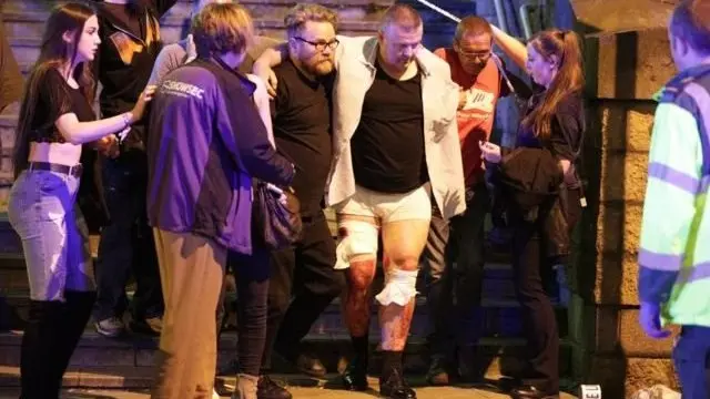 මැන්චෙස්ටර් නගරය අවට රෝහල් හයක තුවාල ලැබුවන්ට ප්‍රතිකාර කෙරේ.