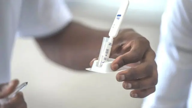Testing kit for HIV