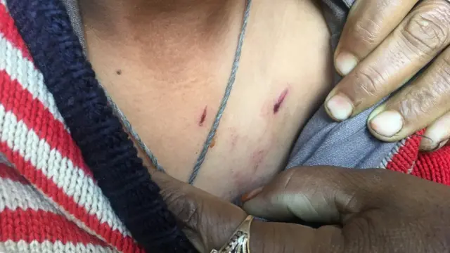 शेलिंग में चोटिल बिलाल