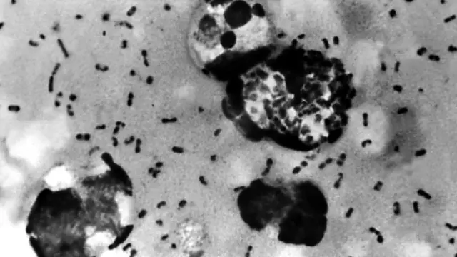 பிளேக் கிருமி