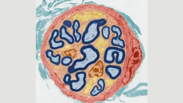 صورة لإحدى الخلايا