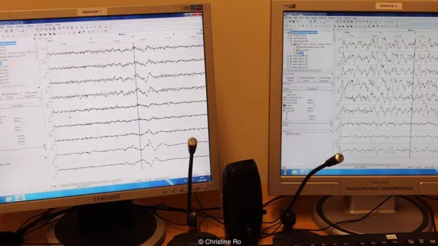 aktivitas otak, tidur